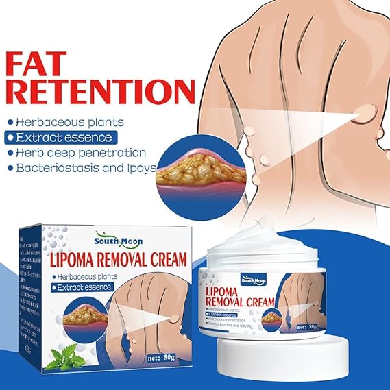 Lipoma Removal Cream