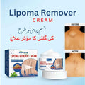 Lipoma Removal Cream
